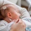 VP Shunt Surgery for Infant Hydrocephalus: How Brain Fluid Drainage Works, Recovery, Shunt Malfunction Signs, and Long-Term Care