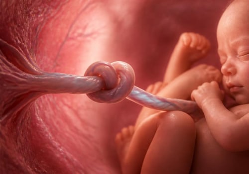 True umbilical cord knots during pregnancy: how a tightened knot can restrict oxygen and affect newborn health