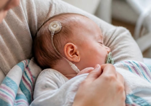 VP Shunt Surgery for Infant Hydrocephalus: How Brain Fluid Drainage Works, Recovery, Shunt Malfunction Signs, and Long-Term Care